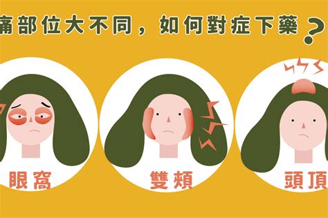 常頭痛|頭痛怎麼辦？何時該就醫？秒懂頭痛原因、位置及症狀…